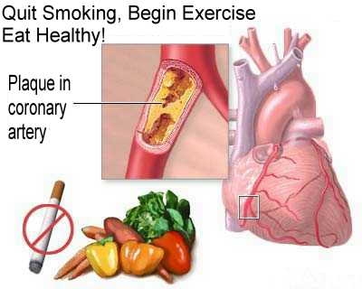 Fumado kaj diabeto: ekzistas efiko sur sango