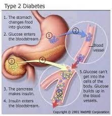 Diabetes Angiopatia