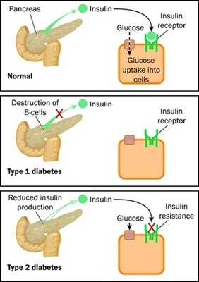 Ubi est productum insulin quod et munus suum