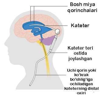 Kattalar va bolalarda diabetning sabablari