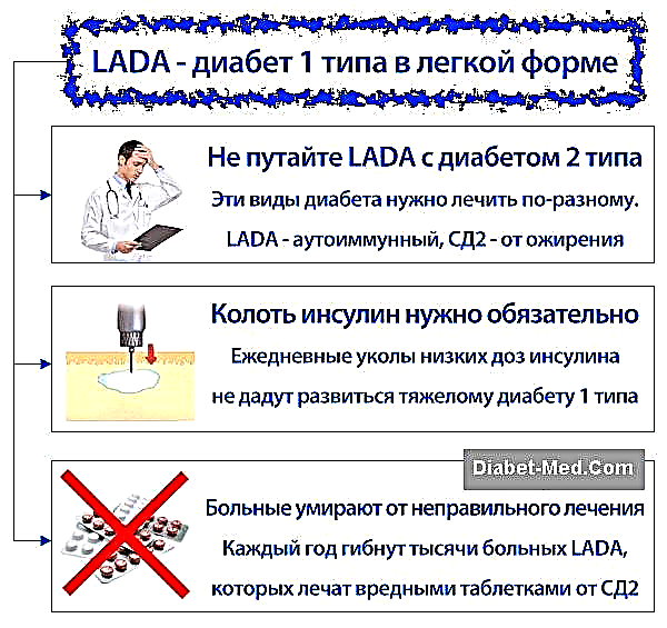 Жеңіл түрдегі LADA 1 типті қант диабеті