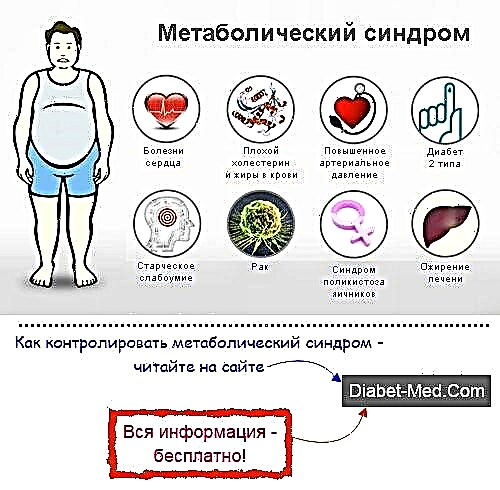 Sindrom metabolik: diagnosis lan perawatan. Diet kanggo sindrom metabolik
