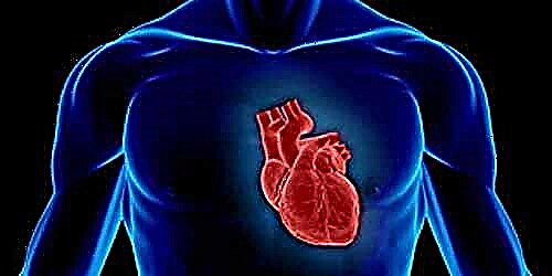 Титэм судасны атеросклерозын кардиосклероз гэж юу вэ?