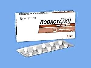 Холестеринге арналған Ловастатин препараты: бағасы және аналогтары