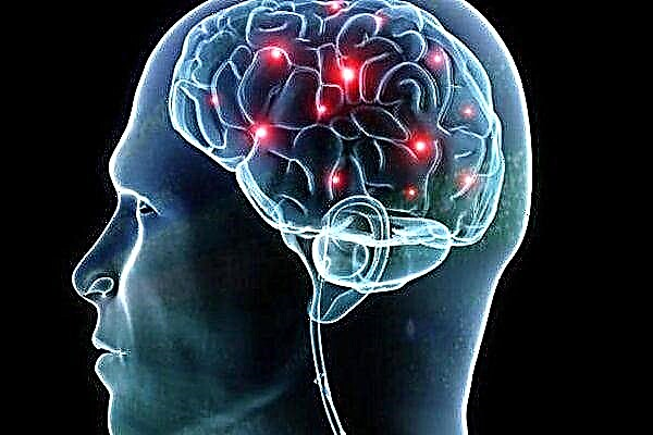 Liječenje moždane ateroskleroze moždanih žila
