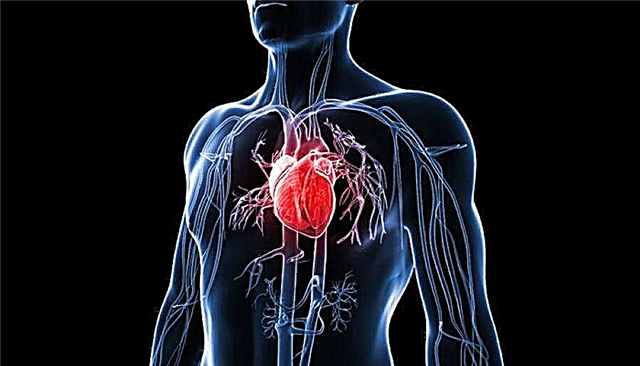 Kardioskleroza aterosklerotike pas infarktit: çfarë është?