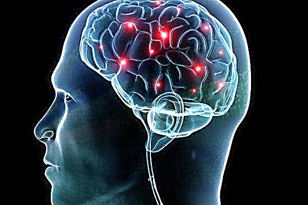 Тархины доод мөч ба судасны атеросклерозын талаар ямар эмчтэй холбоо барих вэ?