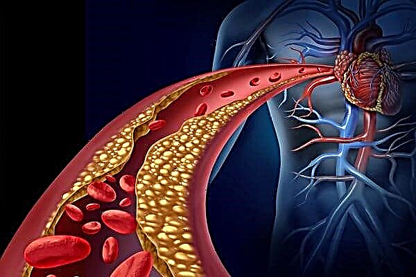 Ateroskleroz va ichki kasalliklar: munosabatlar