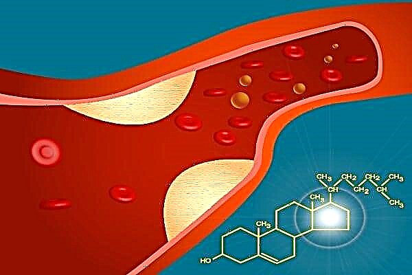 Kako povećati holesterol visoke gustoće u krvi?