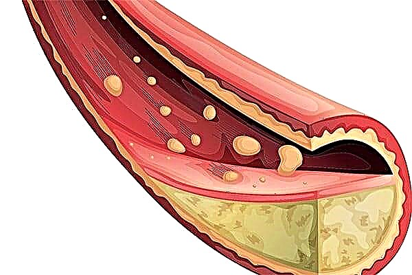Wat erhéicht Blutt Cholesterol bei Fraen?