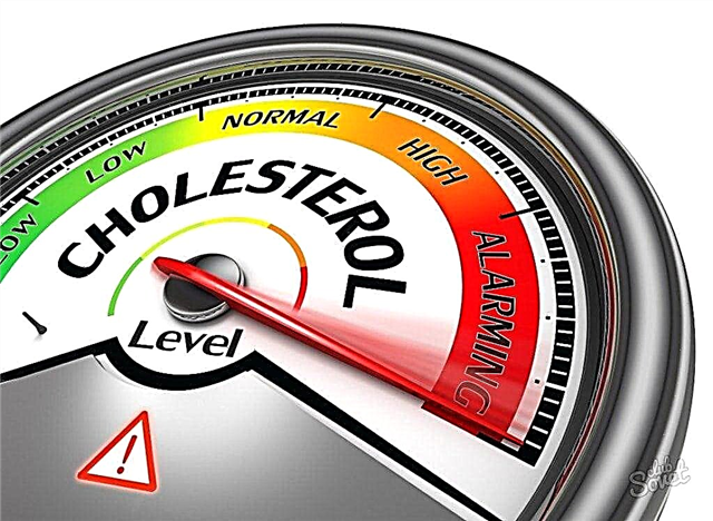La normo de sanga kolesterolo en viroj post 40-50 jaroj