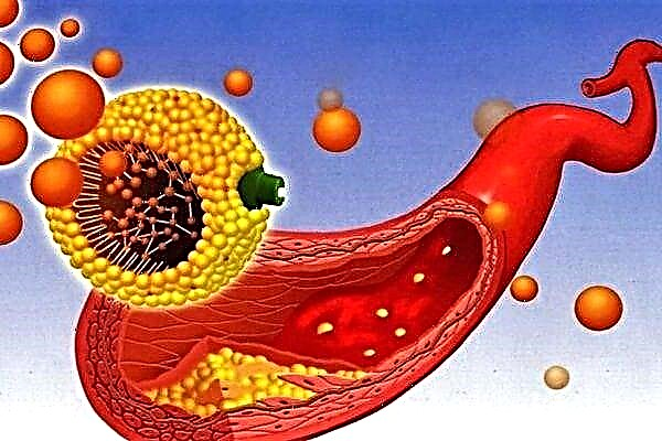 Metabolism ya cholesterol na kazi zake katika mwili wa binadamu