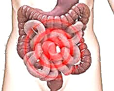 Holesterol u crijevima: učinak na mikrofloru želuca