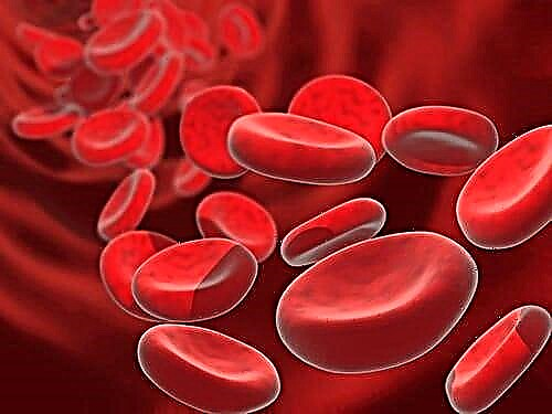 Dekodéierung vun engem Bluttest fir Zocker a Cholesterol bei Erwuessenen: Dësch