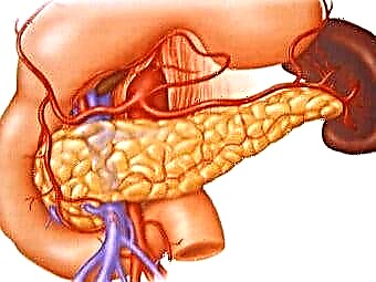 Pankreasın kistaları və fistulaları