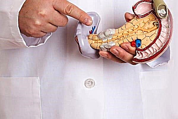 Ascites mewn pancreatitis cronig: symptomau a thriniaeth
