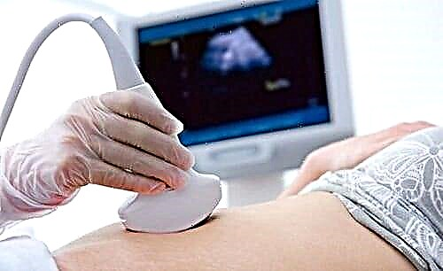 Rêzikên pankreas ên negotî li ser ultrasound: ew çi ye?