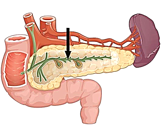 Вируснунг канал на панкреасот: третман за експанзија и контракција