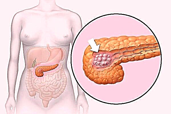 Hipokea formado en la kapo de la pankreato