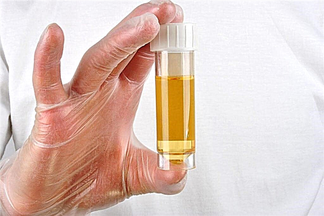 Isfarë është diastaza e pankreasit në një test urina?