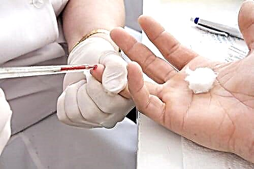خون روی پروفایل گلیسمی: چگونه می توان برای دیابت آزمایش کرد؟