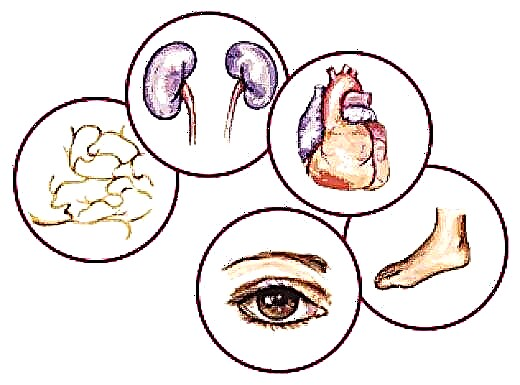 લો બ્લડ શુગરનાં લક્ષણો: તીવ્ર ઘટાડાનાં કારણો