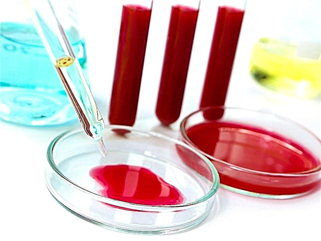 Proba de glicosa en sangue: normal e transcrición