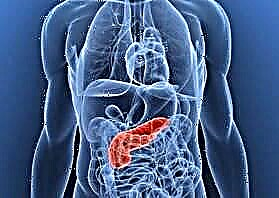 Ecografía do páncreas na diabetes: cambios de órganos na pancreatite