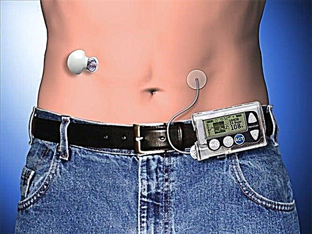 Мертронични пумпи за инсулин: упатства за употреба за дијабетес