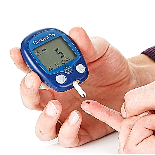 Test na dijabetes: kako odrediti vrstu bolesti?