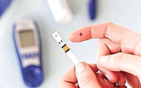 Glimekomb: diabetik tabletkalarni ko'rib chiqish