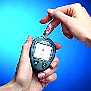 Dijabetes tipa 2: liječenje efikasnim lijekovima i tabletama