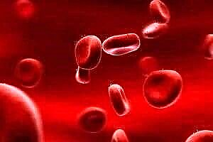 Emakumeetan hemoglobina glikatikoaren tasa: adinaren araberako adierazleen taula
