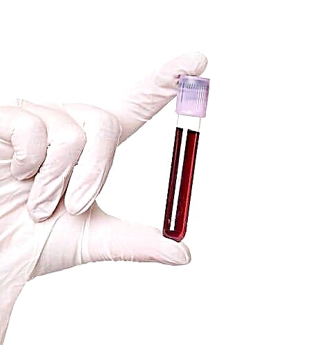 Specimen de sango por sukero: de kie venas analizo de glukozo?
