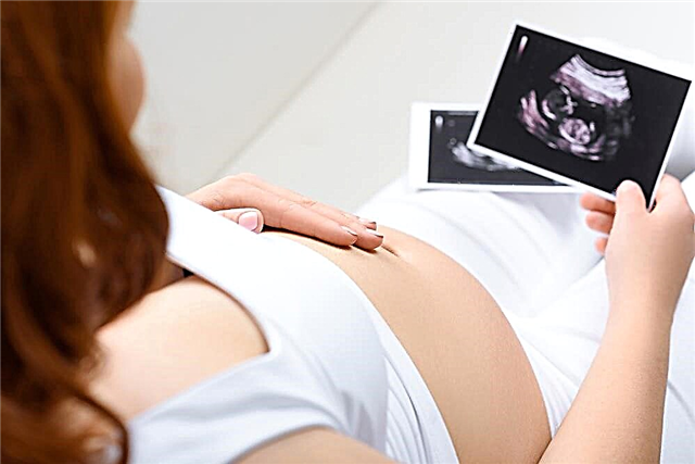 په میرمنو کې د شکری ناروغي څوک نشي کولی حامله شي: د IVF مرسته به وکړي
