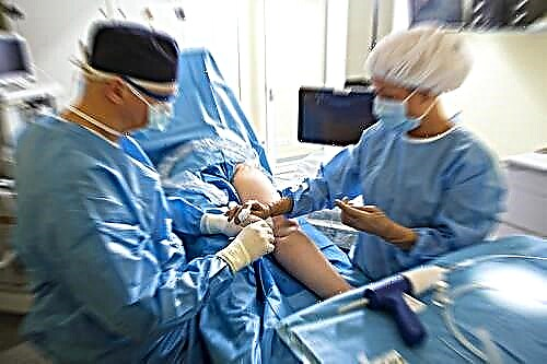 મોસ્કોના ડોકટરોએ ડાયાબિટીસના પગની વિચ્છેદન વિના સારવાર કરવાનું શીખ્યા છે