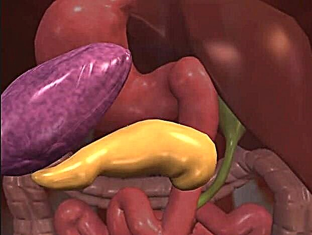 Di pancreas diabétes: kumaha sareng naon anu diubaran (pikeun pulih)