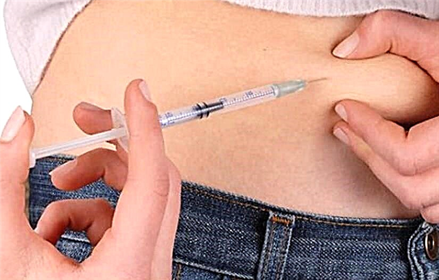 روش برای تزریق زیر جلدی انسولین: قوانین ، ویژگی ها ، سایت های تزریق