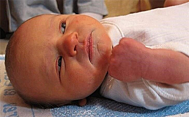 Зголемен билирубин во крвта на новороденче: причини, симптоми (знаци), последици