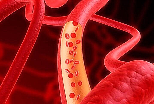 HDL cholesterol an ɗaukaka shi: menene ma'anarsa da kuma yadda za'a ƙara yawan ƙwayoyin lipoproteins da yawa