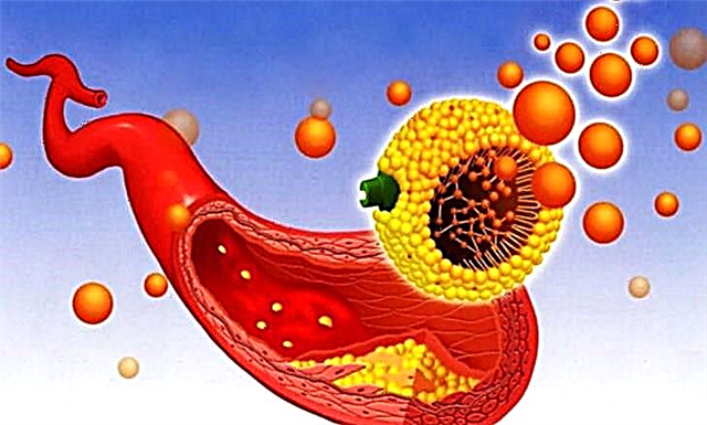 Kolesterol LDL: tingkat getih normal
