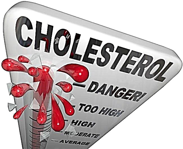 Третман на холестерол во крвта: Превенција на лекови на високо ниво