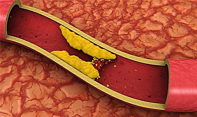 کون سے کھانے سے جسم میں کولیسٹرول خارج ہوتا ہے