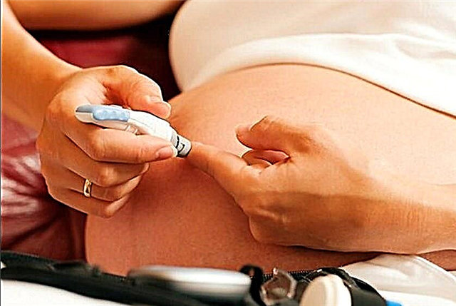Porođaj i trudnoća sa šećernom bolešću tipa I i II