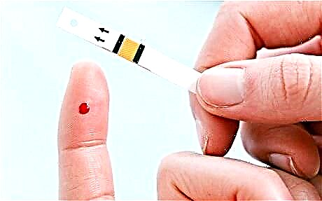 Test online i diabetit për 10 vitet e ardhshme