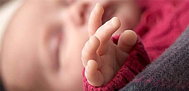 Fetal dyetetik fetal: sentòm, kijan pou trete