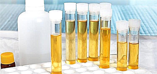 Fitur koleksi analisis urin miturut Nechiporenko, persiyapan, asil