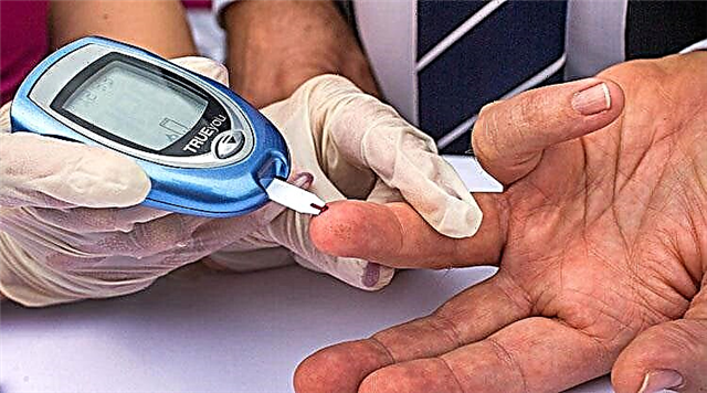 Tarkibsiz diabet: belgilari, davolash va xavfli