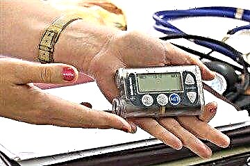 Inzulinska pumpa za odrasle i djecu - kako je dobiti besplatno?