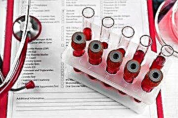 Niveis de azucre no sangue admisibles - táboa de normas por idade